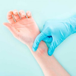 Аллергия на латексные перчатки: как предотвратить?