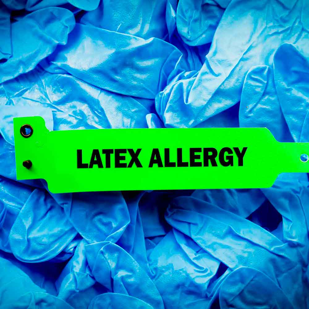 Аллергия на латексные перчатки у врачей и пациентов