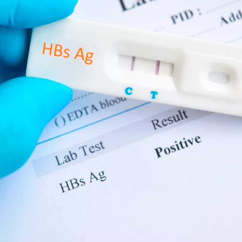 Тест-система для выявления HBsAg маркера к вирусу гепатита В