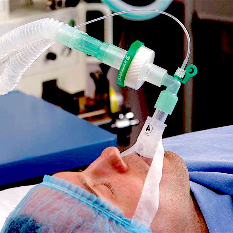 Фильтр электростатический для анестезиологии и вентиляции легких